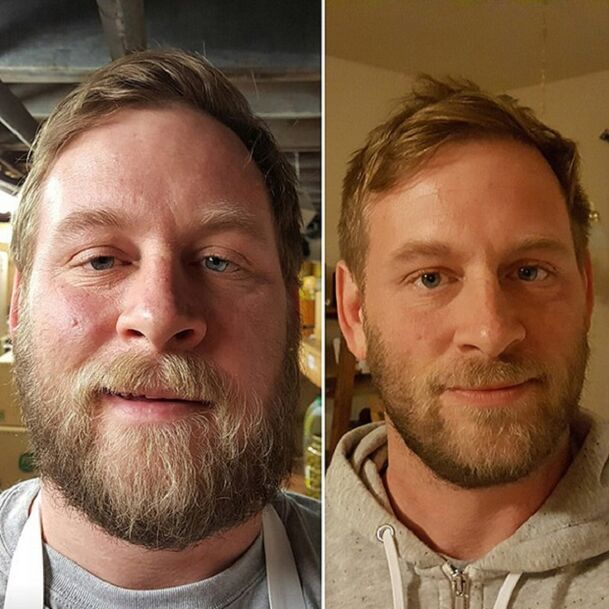 l'apparence de la personne avant et après avoir arrêté l'alcool